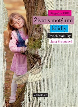 Diagnóza EBD: Život s motýlími křídly koupíte na Kosmas.cz