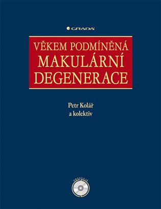 Věkem podmíněná makulární degenerace