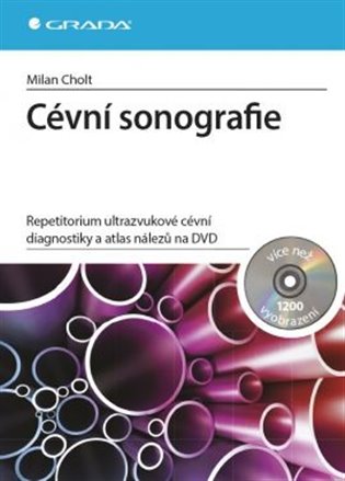 Cévní sonografie. repetitorium ultrazvukové cévní diagnostiky a atlas nálezů na DVD koupíte na Kosmas.cz