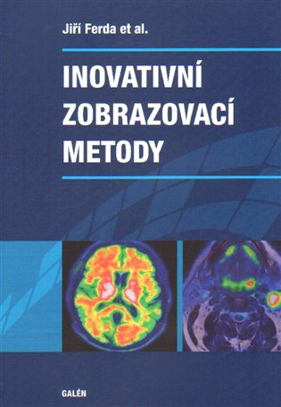 Inovativní zobrazovací metody koupíte na Kosmas.cz