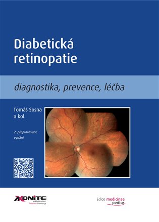 Diabetická retinopatie koupíte na Kosmas.cz