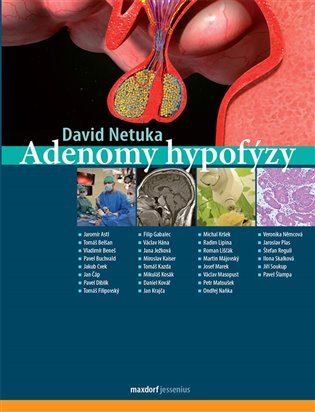 Adenomy hypofýzy koupíte na Kosmas.cz