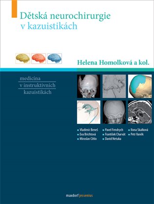 Dětská neurochirurgie v kazuistikách