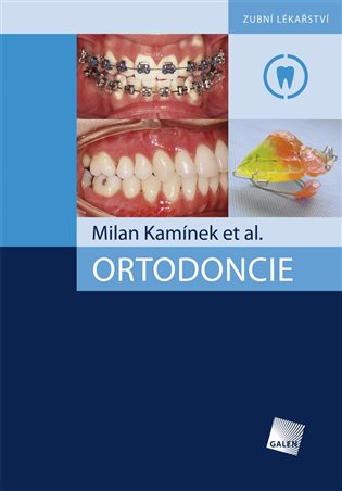 Ortodoncie koupíte na Kosmas.cz