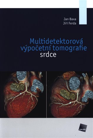 Multidetektorová výpočetní tomografie srdce koupíte na Kosmas.cz