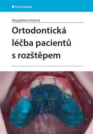 Ortodontická léčba pacientů s rozštěpem