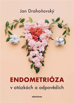 Endometrióza v otázkách a odpovědích koupíte na Kosmas.cz