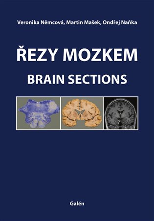 Řezy mozkem