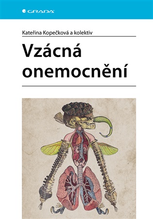 Vzácná onemocnění