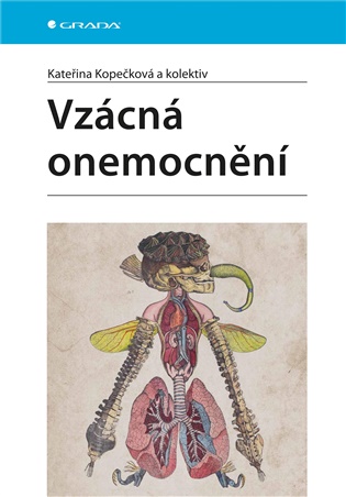 Vzácná onemocnění